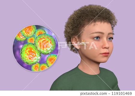 Otitis media in a child, 3D illustration 119101469