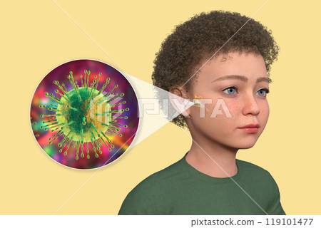 Otitis media in a child, 3D illustration 119101477