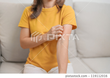 woman itching and scratching itchy arm. Sensitive Skin Allergic reaction to insect bite, food, drug dermatitis. Dermatology, Leprosy day, Systemic lupus erythematosus, Allergy symptoms and rash Eczema 119112016