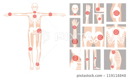 Human figure highlighting common pain points linked to rheumatic disorders, including joints and skeletal regions in a clear, educational format 119118848