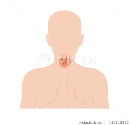 Human body highlighting pain spots, with a focus on the central neck area, indicating potential discomfort or stress areas relevant to human health 119118862