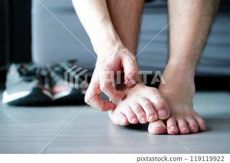Men wear canvas shoes, he scratches legs and feet with itchy skin. Caused by  of shoes 119119922