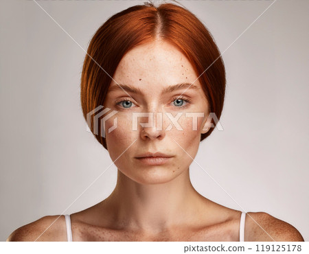 Woman Suffering From Sun Damage Actinic Keratosis 119125178