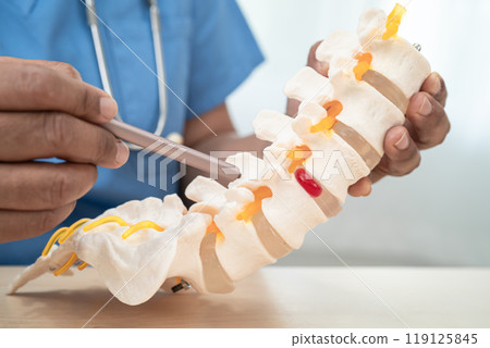 Doctor with lumbar vertebra bone skeleton and nerve model for treatment in the orthopedic department. 119125845