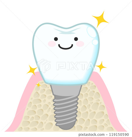 植入物（角色） 119150590