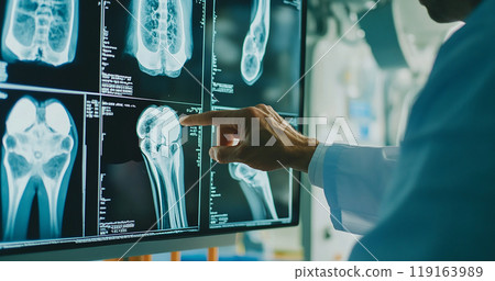 X-ray image of a human knee joint. Orthopedic surgeon doctor examining patient's knee joint x-ray films. Doctor examine patient's joint x-ray scan. 119163989
