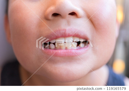younger, teeth, mouth 119165579