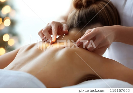 Holistic wellness: ancient practice of acupuncture, delicate placement of needles on the human body, emphasizing balance, healing, and the therapeutic benefits of this traditional method. Holistic wellness: ancient practice of acupuncture, delicate placement of needles on the human body, emphasizing balance, healing, and the therapeutic benefits of this traditional method. 119167663