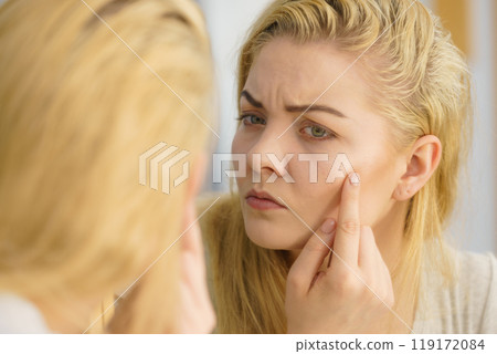 Woman looking at her skin in mirror 119172084
