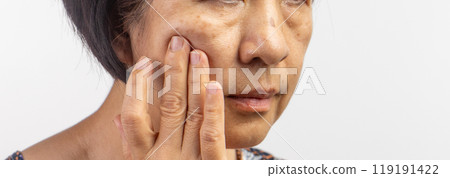 Flabby and wrinkled skin on senior woman face. 119191422