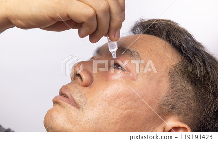 Senior man use antibiotic eye drops to treat swollen eye from insect bite. Senior man use antibiotic eye drops to treat swollen eye from insect bite. 119191423
