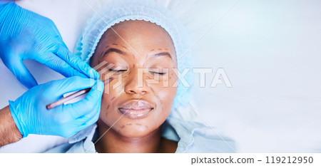 Plastic surgery, pen and black woman sleep on a hospital bed with dermatology with mockup space. Surgeon, facial change and medical filler for skincare, cosmetics and wellness in a clinic with doctor 119212950