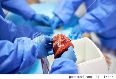 Transplant, surgery and doctors with organ in hospital for medical service, procedure and operation. Healthcare, teamwork and hands with in theater for donation from injury, accident and emergency 119213777