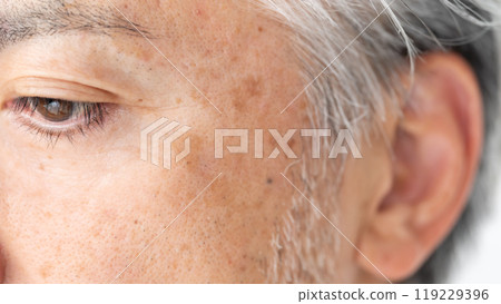 男士美容祛斑眼部區域 119229396
