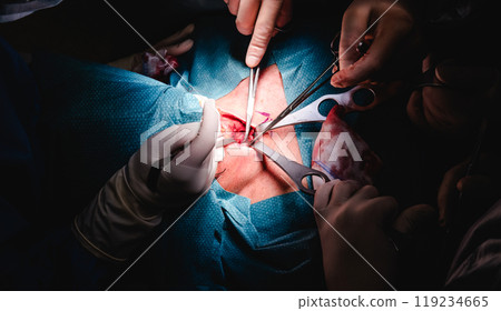 Surgeons performing a procedure with precision using surgical instruments in an operating room Surgeons performing a procedure with precision using surgical instruments in an operating room 119234665