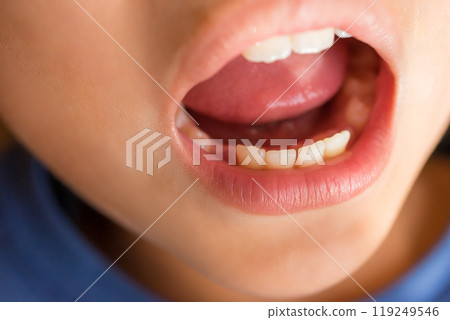 younger, teeth, mouth 119249546