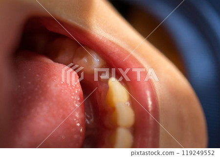 younger, teeth, mouth 119249552