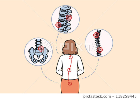 Woman with sore spine stands with back to camera and needs help of massage therapist or osteopath 119259443