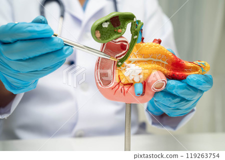 Pancreatitis, pancreatic cancer, Asian doctor with pancreas, gallbladder and bile duct human anatomy model at hospital. Pancreatitis, pancreatic cancer, Asian doctor with pancreas, gallbladder and bile duct human anatomy model at hospital. 119263754