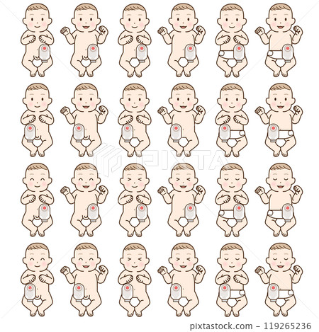 Artificial anus, stoma, colon, child, baby, illustration 119265236