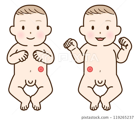 結腸造口、造口、大腸、兒童、兒童、嬰兒、插圖、插圖 結腸造口、造口、大腸、兒童、兒童、嬰兒、插圖、插圖 119265237