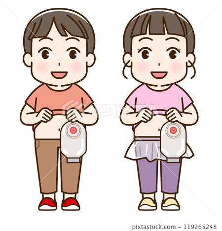 Artificial anus, stoma, colon, child, baby, illustration 119265248