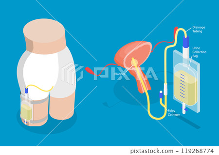 3D Isometric Flat Vector Illustration of Drainage Bladder, Flexible Rubber Urine Bag For Bladder Infections Treatment 119268774