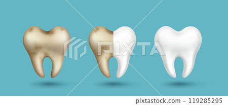 Realistic tooth - dirty gray and clean white 119285295
