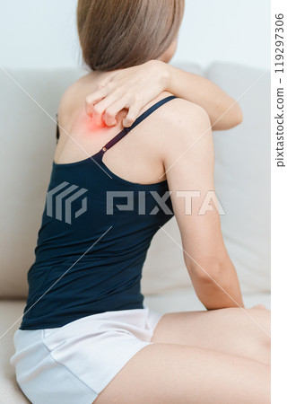 woman itching and scratching itchy back. Sensitive Skin Allergic reaction to insect bite, food, drug dermatitis. Dermatology, Leprosy, Systemic lupus erythematosus, Allergy symptoms and rash Eczema 119297306