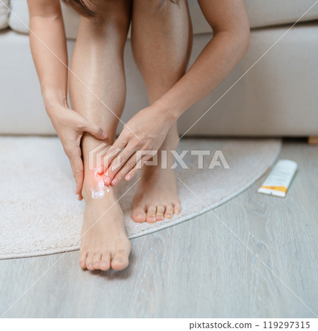Arthritis and Muscle Pain Relief Cream concept. woman having leg pain due to Ankle Sprains or Achilles Tendonitis and Shin Splints ache. injuries, health and medical concept Arthritis and Muscle Pain Relief Cream concept. woman having leg pain due to Ankle Sprains or Achilles Tendonitis and Shin Splints ache. injuries, health and medical concept 119297315