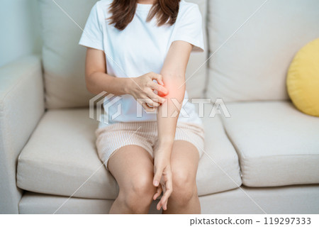 woman itching and scratching itchy arm. Sensitive Skin Allergic reaction to insect bite, food, drug dermatitis. Dermatology, Leprosy day, Systemic lupus erythematosus, Allergy symptoms and rash Eczema 119297333