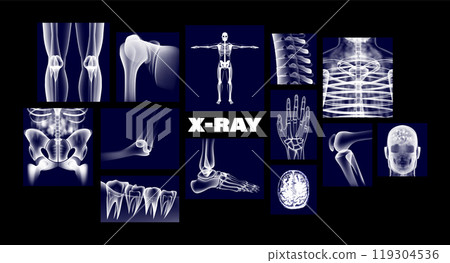 Medical X-ray 3D images of the human body Medical X-ray 3D images of the human body 119304536