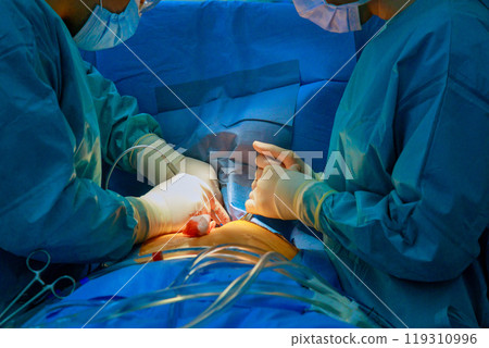 During open heart surgery at hospital, medical team of surgeons performs surgery on patient 119310996
