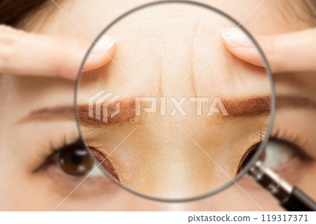 A magnifying glass zooms in on the wrinkles between a woman's eyebrows. A magnifying glass zooms in on the wrinkles between a woman's eyebrows. 119317371