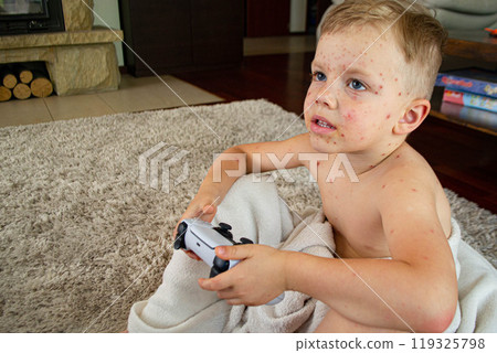 Natural vaccination. Contagious disease. Natural vaccination. Contagious disease. 119325798