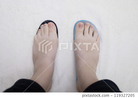 Presentation of incorrect footwear that deforms the foot. Small size of the insole, which causes pain in the foot and valgus. After an example of an anatomical insole Presentation of incorrect footwear that deforms the foot. Small size of the insole, which causes pain in the foot and valgus. After an example of an anatomical insole 119327205