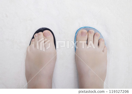 Presentation of incorrect footwear that deforms the foot. Small size of the insole, which causes pain in the foot and valgus. After an example of an anatomical insole Presentation of incorrect footwear that deforms the foot. Small size of the insole, which causes pain in the foot and valgus. After an example of an anatomical insole 119327206