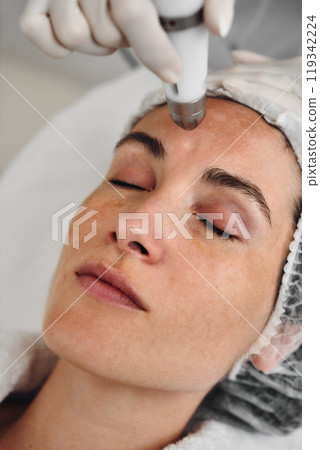 Woman receiving a facial treatment in a spa during a skincare session 119342224