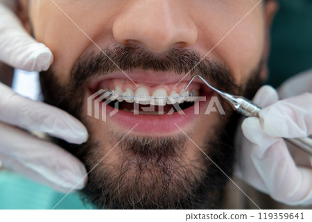 teeth, mouth, dental 119359641