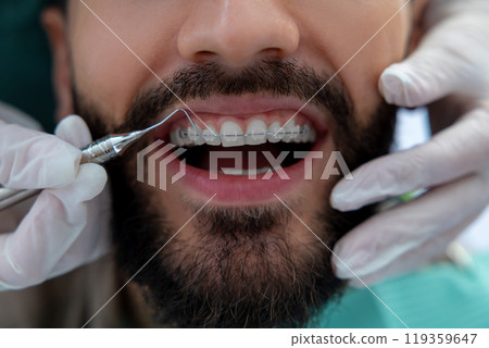 Unknown dentist doing oral examination with advanced dental equipment for patient 119359647