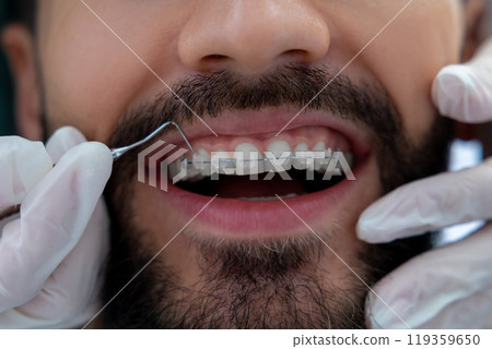 Doctor in dental clinic wearing gloves carefully inspecting patient’s mouth with precise instruments 119359650