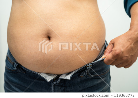 Overweight Asian woman show and use hand to squeeze fat belly. 119363772