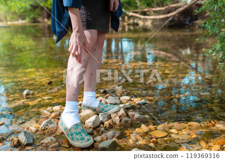 Young woman scratching her leg due to insect bite in nature. Leg covered in a rash. In the background trees and river. Insect protection concept. Close up Young woman scratching her leg due to insect bite in nature. Leg covered in a rash. In the background trees and river. Insect protection concept. Close up 119369316