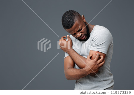 Insect bite allergy. Young afro man scratching his itching hand, white background, copy space 119373329