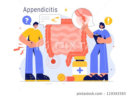 Appendicitis Vector Illustration Featuring Inflammation of the Appendix and Stomach Treatment in a Healthcare Flat Style Cartoon Background 119383565
