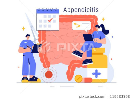 Appendicitis Vector Illustration Featuring Inflammation of the Appendix and Stomach Treatment in a Healthcare Flat Style Cartoon Background 119383598