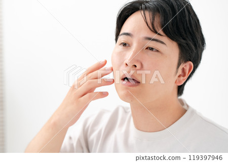 Men suffering from skin problems, beard 119397946