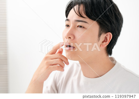 Men suffering from skin problems, beard Men suffering from skin problems, beard 119397947