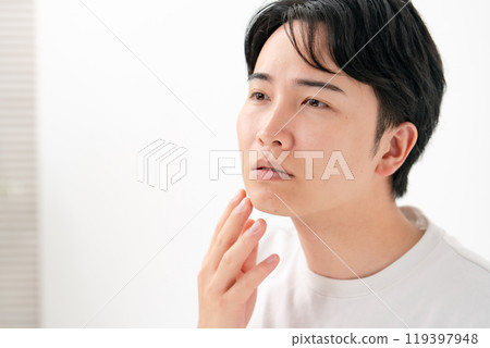 Men suffering from skin problems, beard Men suffering from skin problems, beard 119397948