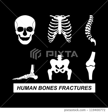 Human bones fractures icon Human bones fractures icon 119400772